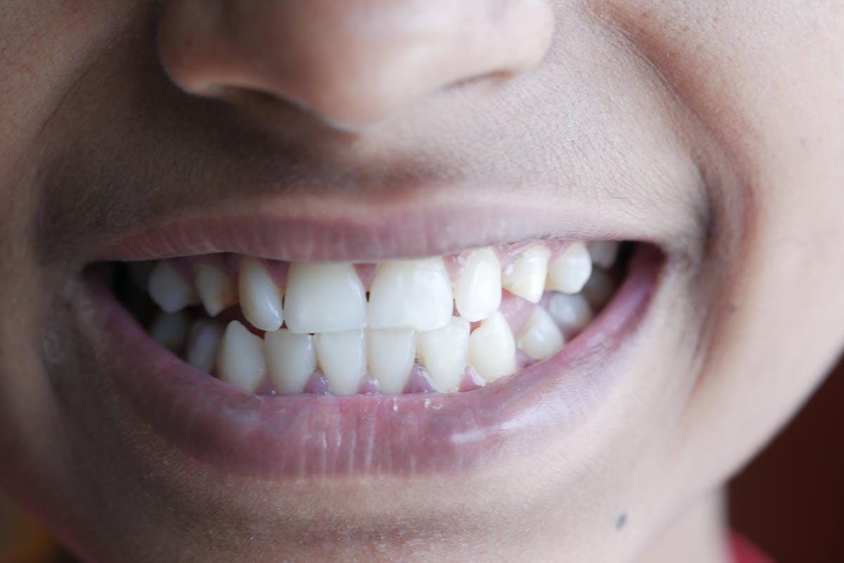 A bright, healthy smile